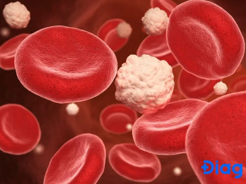 Tăng áp lực thẩm thấu do tăng đường huyết (HHS) là một biến chứng cấp tính nguy hiểm